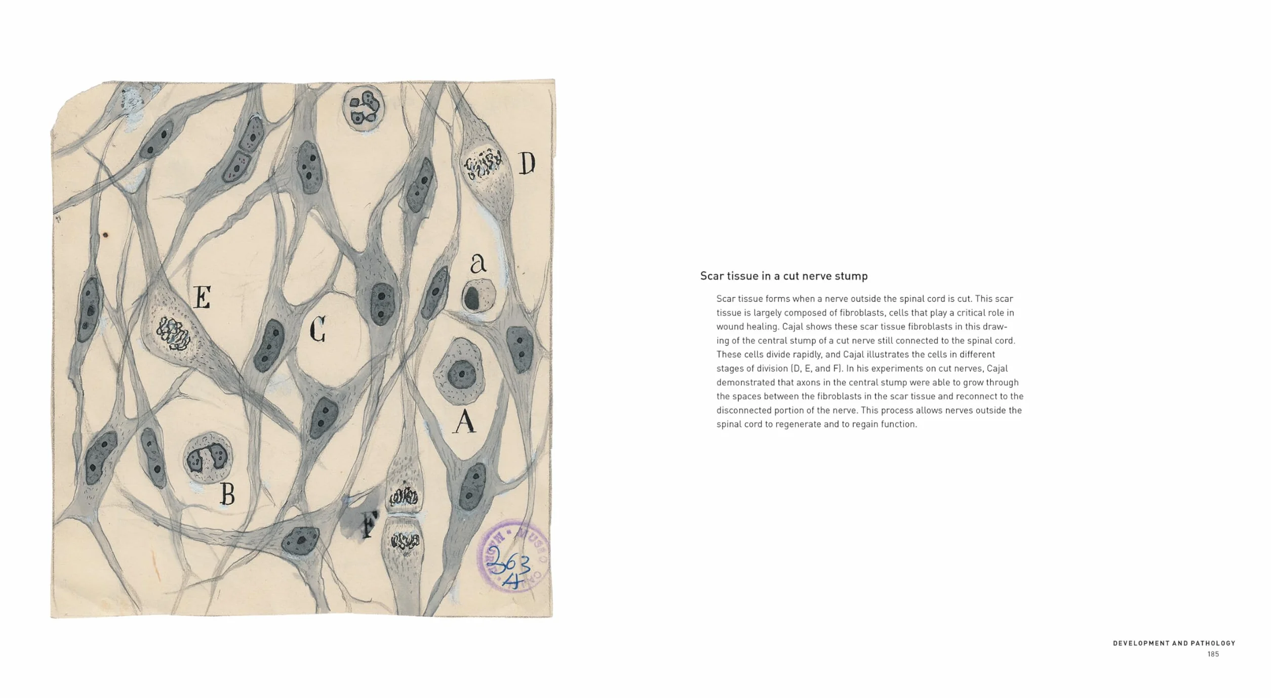 The Beautiful Brain: The Drawings of Santiago Ramón y Cajal